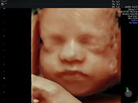 妊娠30週台 3D4Dイメージ2