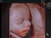 妊娠20週台 3D4Dイメージ2