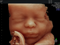 妊娠30週台 3D4Dイメージ1
