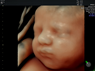 妊娠30週台 3D4Dイメージ3