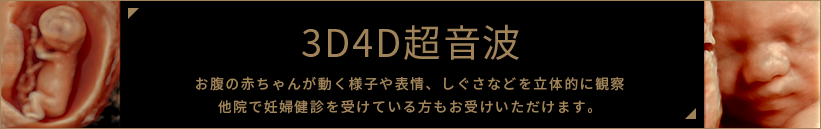 3D4D超音波